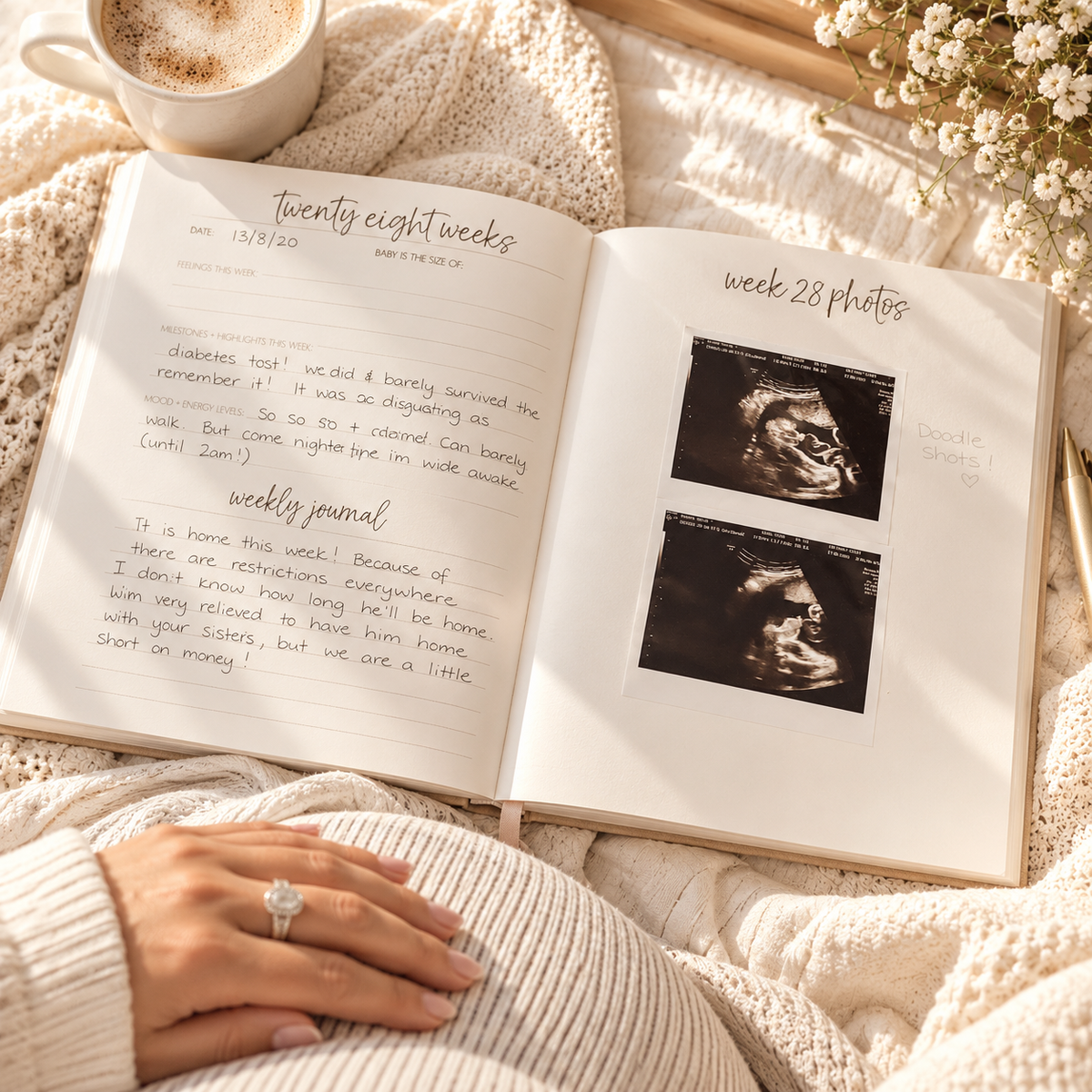 Hands holding open the pregnancy journal to a filled-in page with ultrasound photos